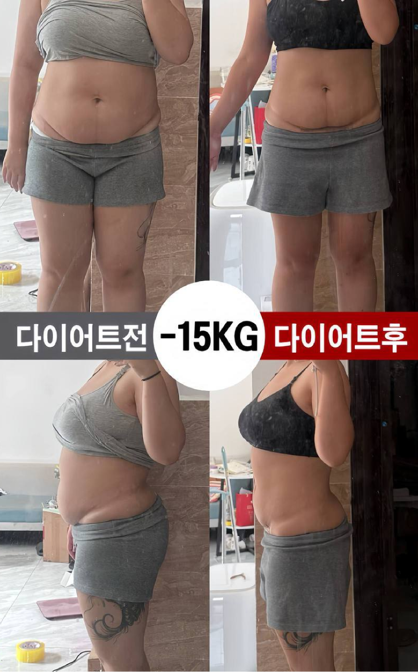 건강 관리 사용 사례