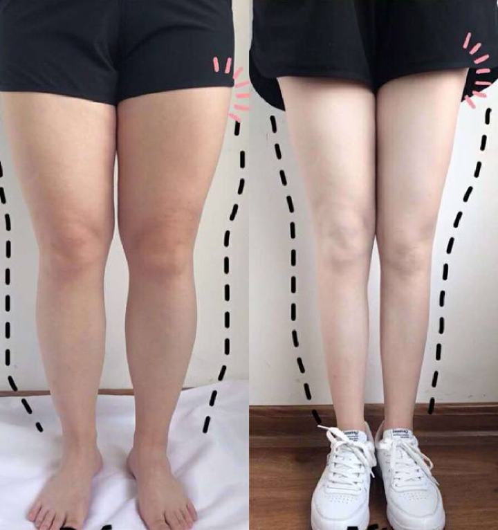 건강 관리 사례